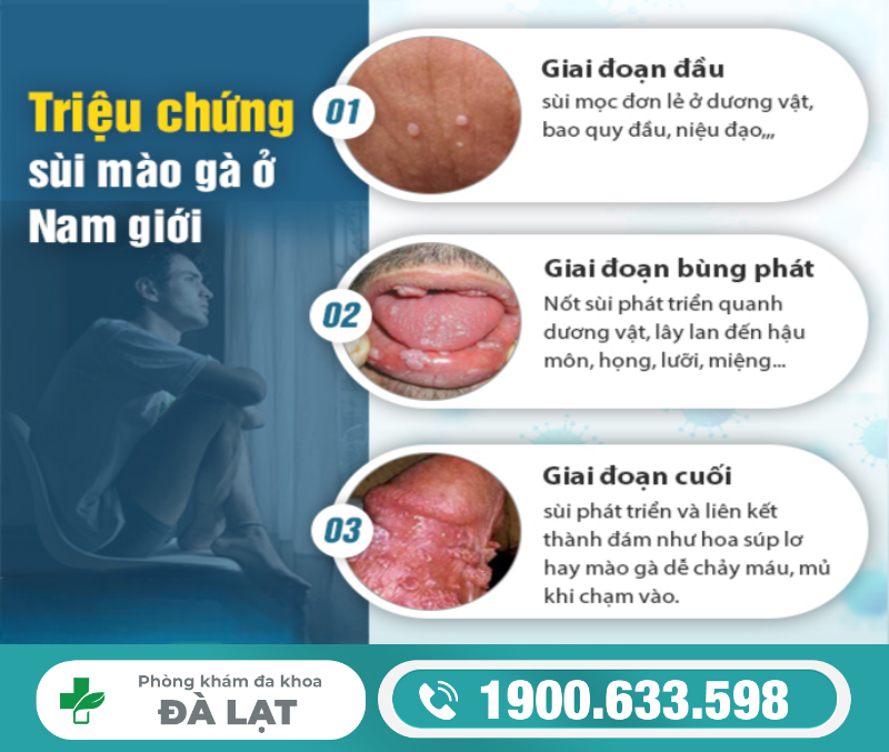 Hình ảnh minh họa